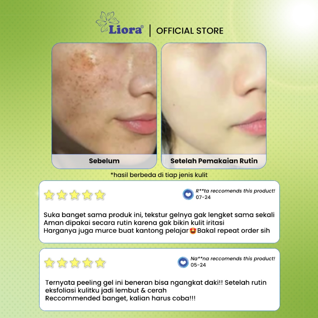 LIORA Peeling Gel (Green Tea Extract) 120ML - Image 2