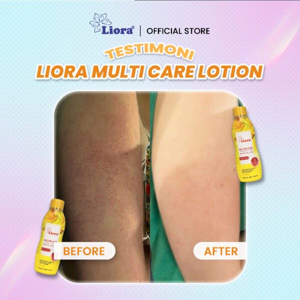 LIORA Whitening Body Lotion (Yellow) 600ML - Image 4