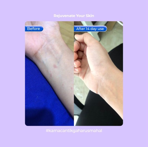 LIORA Booster Whitening Body Serum (DNA Salmon) - 750ML - Image 7